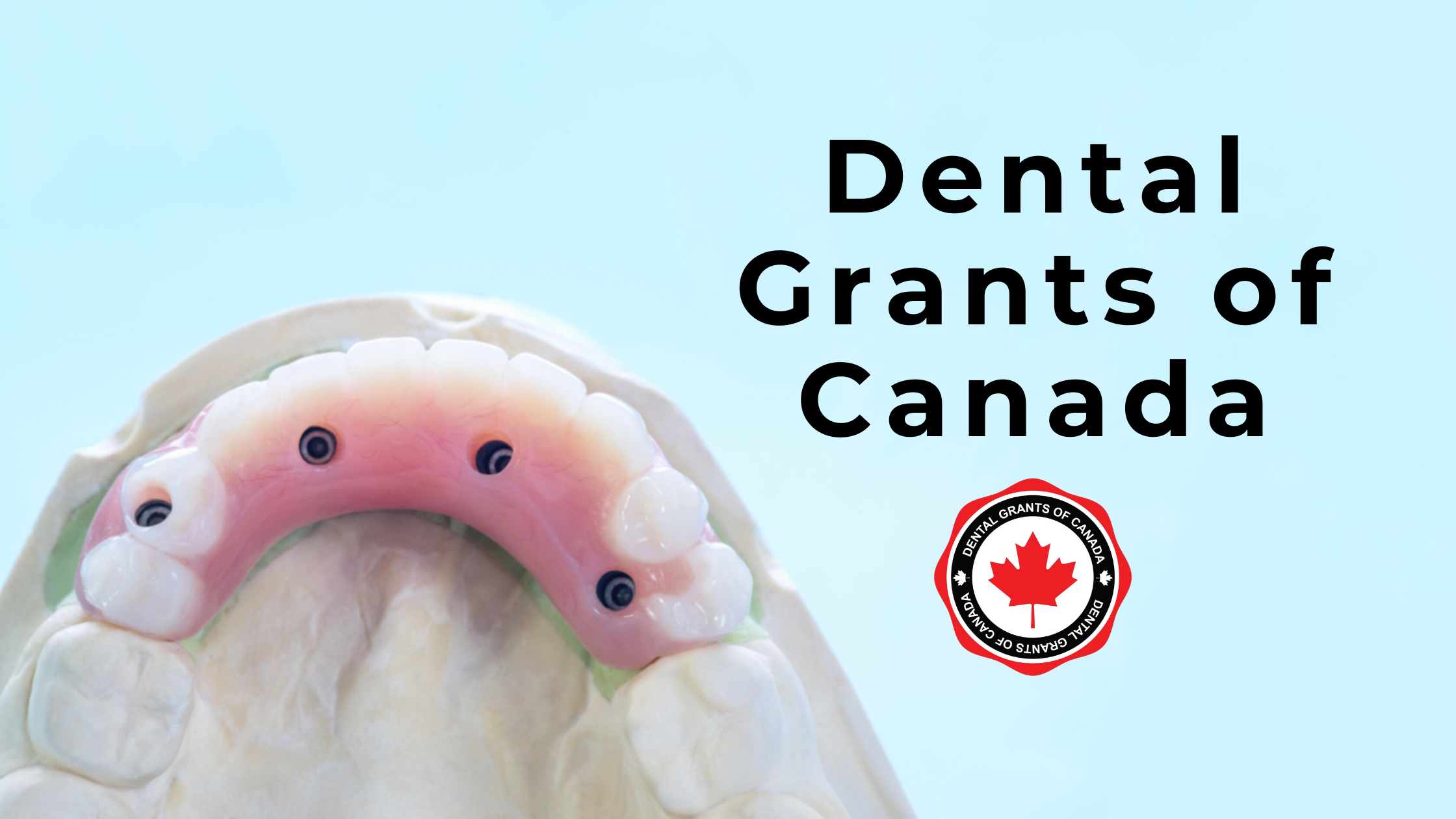 Dental Grants AllOnFour Implants